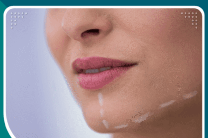 أفضل دكتور تحديد الفك في اسطنبول