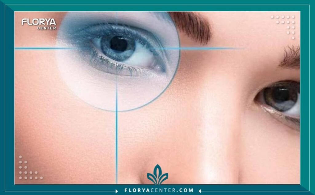 a1 15 - دكتور عيون لعلاج القرنية المخروطية في تركيا عندما يتعلق الأمر بـ "القرنية المخروطية"، فإن البحث عن أفضل دكتور عيون لعلاج القرنية المخروطية في تركيا ليس مجرد خيار طبي، بل هو قرار حاسم لإنقاذ البصر. هذا المرض، الذي يتسبب في ترقق القرنية وتحولها التدريجي إلى شكل مخروطي، يمكن أن يهدد جودة الحياة بشكل كبير إذا لم يُعالج بالشكل الصحيح. تركيا، وخاصة اسطنبول، برزت كمركز عالمي رائد في طب العيون، حيث تجمع بين الخبرات الطبية الفائقة وأحدث التقنيات التشخيصية والعلاجية.