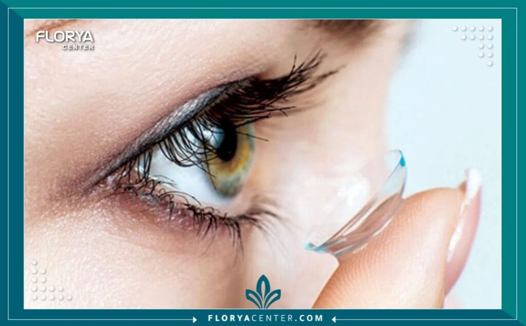 a4 17 - دكتور عيون لعلاج القرنية المخروطية في تركيا عندما يتعلق الأمر بـ "القرنية المخروطية"، فإن البحث عن أفضل دكتور عيون لعلاج القرنية المخروطية في تركيا ليس مجرد خيار طبي، بل هو قرار حاسم لإنقاذ البصر. هذا المرض، الذي يتسبب في ترقق القرنية وتحولها التدريجي إلى شكل مخروطي، يمكن أن يهدد جودة الحياة بشكل كبير إذا لم يُعالج بالشكل الصحيح. تركيا، وخاصة اسطنبول، برزت كمركز عالمي رائد في طب العيون، حيث تجمع بين الخبرات الطبية الفائقة وأحدث التقنيات التشخيصية والعلاجية.