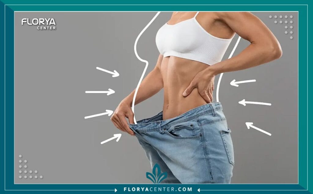 a4 2 - جراحة تجميل ما بعد فقدان الوزن اسطنبول هل حققت حلمك في الوصول إلى الوزن المثالي ولكنك شعرت بخيبة أمل بسبب ترهلات الجلد العنيدة التي تخفي إنجازك؟ إن جراحة تجميل ما بعد فقدان الوزن اسطنبول (Post-Weight Loss Surgery) ليست مجرد إجراء تجميلي لرفاهية المظهر، بل هي بوابتك الحقيقية لاستكمال رحلة التعافي واستعادة الوظائف الحيوية للجسم والثقة بالنفس. بعد رحلة شاقة من الحميات الغذائية القاسية أو جراحات السمنة (مثل التكميم وتحويل المسار)، يجد المريض نفسه محاصراً بجلد زائد لا يستجيب للرياضة، وهنا يأتي الدور الطبي الحاسم للجراحة التجميلية لتعيد رسم حدود الجسد وتمنحك القوام الذي طالما سعيت إليه. في تركيا، وتحديداً في مركز فلوريا، تحولت هذه الجراحات إلى فن طبي دقيق يجمع بين التكنولوجيا المتقدمة والخبرة الجراحية لضمان نتائج تغير مجرى الحياة.