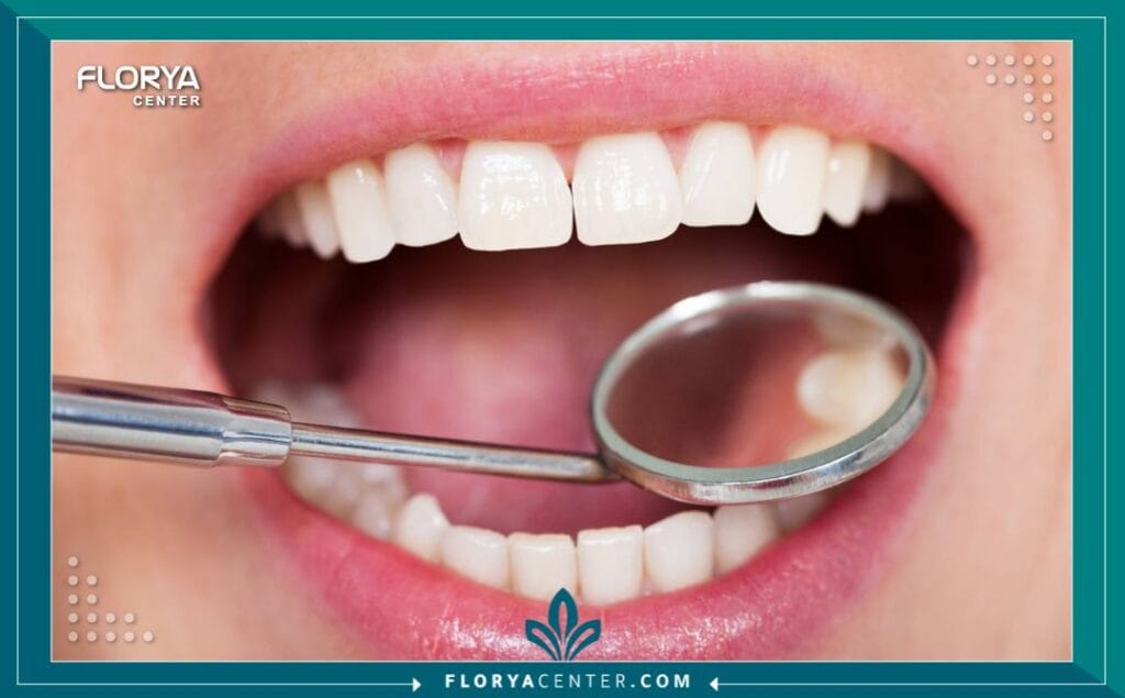 aa2 4 - تكلفة علاج الأسنان الكامل في تركيا لطالما كانت الابتسامة الواثقة مفتاحاً للقلوب وبوابة للفرص. لكن عندما تواجه الأسنان تحديات صحية أو وظيفية، يتحول البحث عن حل من مجرد تجميل إلى ضرورة ملحة. هنا، تبرز تكلفة علاج الأسنان الكامل في تركيا (Full Mouth Dental Reconstruction) كمنارة أمل، مقدمةً حلاً جذرياً يعيد لك ليس فقط ابتسامتك، بل وظائف الفم الكاملة وثقتك بنفسك. إن البحث عن تكلفة علاج الأسنان الكامل في تركيا ليس مجرد استعلام عن سعر، بل هو الخطوة الأولى في رحلة تغيير شاملة، تجمع بين أعلى معايير الجودة الطبية والأسعار المنطقية.