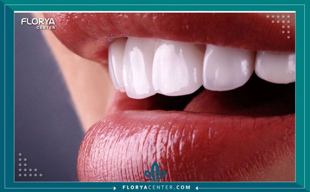 أشهر عيادات الأسنان في اسطنبول 3 b2 13 - أشهر عيادات الأسنان في اسطنبول أصبحت عيادات الأسنان في اسطنبول الوجهة الأولى عالمياً للباحثين عن ابتسامة مثالية تجمع بين الجودة الفائقة والتكلفة المنافسة. لم يعد البحث عن أفضل عيادات الأسنان في اسطنبول مجرد خيار علاجي، بل هو استثمار حقيقي في الثقة بالنفس والمظهر الجمالي المتجدد. في ظل السمعة العالمية التي اكتسبتها تركيا في مجال السياحة العلاجية، برزت اسطنبول كمركز ثقل يجمع أمهر أطباء الأسنان وأحدث التقنيات.