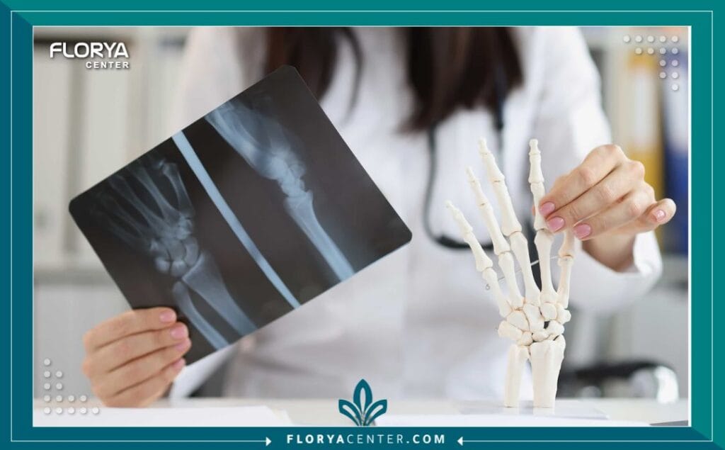 c3 7 - أفضل جراح يد في تركيا يُعد البحث عن أفضل جراح يد في تركيا خطوة حاسمة في رحلة علاجك. اليد البشرية هي تحفة هندسية معقدة، تتألف من شبكة دقيقة من العظام (27 عظمة)، والمفاصل، والأربطة، والأوتار، والأعصاب، والأوعية الدموية. أي إصابة أو حالة مرضية تصيب هذا الهيكل المعقد يمكن أن تؤثر بشكل كبير على جودة الحياة، والقدرة على العمل، وحتى أداء أبسط المهام اليومية.