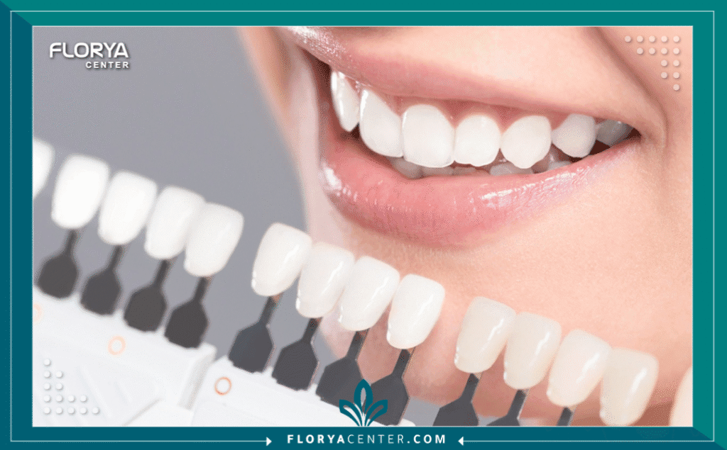 nouralagee93@gmail.com 20250802 095910 ٠٠٠٠ - أنواع عدسات الأسنان (فينير ولومينير) تعتبر أنواع عدسات الأسنان (فينير ولومينير) اليوم واحدة من أكثر الإجراءات طلباً في عالم طب الأسنان التجميلي، فهي تمثل الحل السحري للحصول على "ابتسامة هوليوود" البيضاء والمتناسقة. لم يعد الأمر يقتصر على المشاهير، بل أصبح خياراً متاحاً لكل من يبحث عن تحسين جذري وسريع لمظهر أسنانه. سواء كنت تعاني من تصبغات عميقة، أو كسور بسيطة، أو فراغات لا ترغب بها، فإن عدسات الأسنان (Dental Veneers) تقدم حلاً فعالاً.