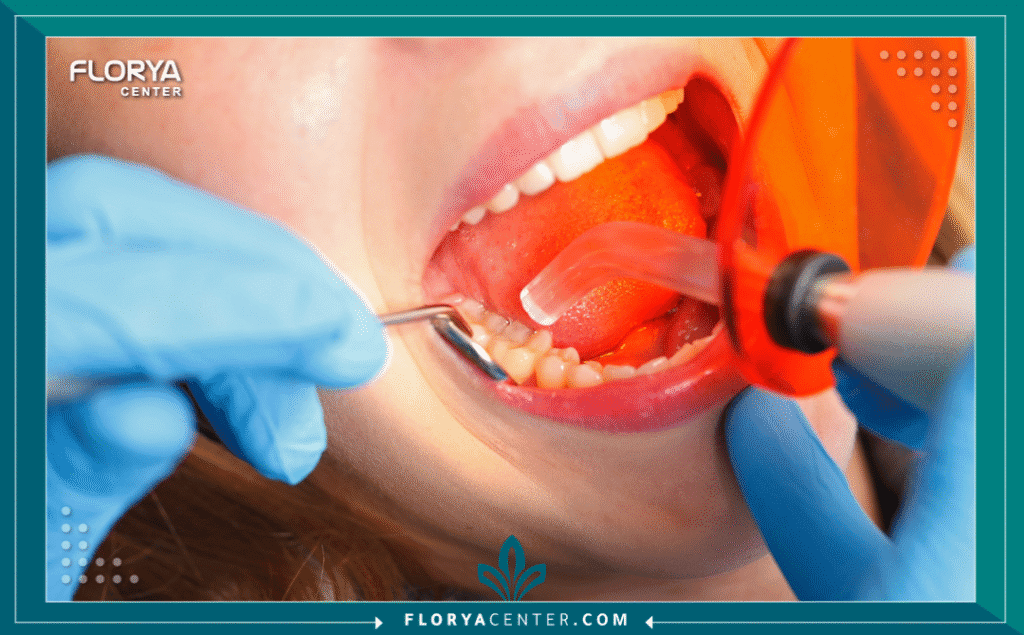 nouralagee93@gmail.com 20250812 194050 ٠٠٠٠ - أنواع حشوات الأسنان يُعد الدليل الشامل لاختيار أفضل أنواع حشوات الأسنان وسد الفراغات خطوتك الأولى نحو استعادة صحة ابتسامتك وجمالها. يُعتبر تسوس الأسنان أحد أكثر المشكلات الصحية شيوعاً في العالم، ويمثل "حشو الأسنان" الإجراء الأساسي والأكثر فعالية لإيقاف هذا التسوس ومنع تفاقمه. مع التقدم الهائل في طب الأسنان الترميمي والتجميلي، لم تعد أنواع حشوات الأسنان (Dental Fillings) تقتصر على وظيفتها العلاجية فحسب، بل أصبحت جزءاً لا يتجزأ من تجميل الابتسامة.