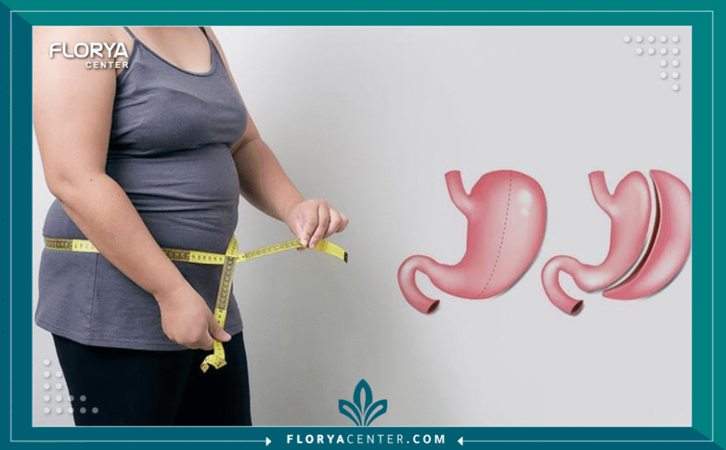 التكميم أم بالون المعدة 3 nouralagee93@gmail.com 20250821 210756 ٠٠٠٠ - التكميم أم بالون المعدة يُمثل قرار الخضوع لإجراء إنقاص الوزن نقطة تحول جذرية في حياة الفرد، وغالباً ما تبدأ الرحلة بسؤال محوري: التكميم أم بالون المعدة؟ في السعي نحو صحة أفضل وجسم مثالي، يبرز هذان الإجراءان كأكثر الخيارات شيوعاً، لكنهما يمثلان فلسفتين علاجيتين مختلفتين تماماً. هل تبحث عن حل جراحي دائم يُغير تشريح المعدة لنتائج طويلة الأمد، أم تفضل تدخلاً غير جراحي ومؤقتاً يمنحك دفعة قوية لتغيير نمط حياتك؟ إن المقارنة بين تكميم المعدة (Gastric Sleeve) وبالون المعدة (Intragastric Balloon) ليست مجرد مقارنة بين تقنيتين، بل هي تقييم دقيق لأهدافك الصحية، التزامك، وحالتك الطبية. هذا الدليل مُصمم ليفكك الفروقات الجوهرية بين الخيارين، ويزودك بالمعرفة الأكاديمية اللازمة لاتخاذ قرار مستنير عند التفكير في رحلتك العلاجية، خاصة في وجهة رائدة مثل تركيا.