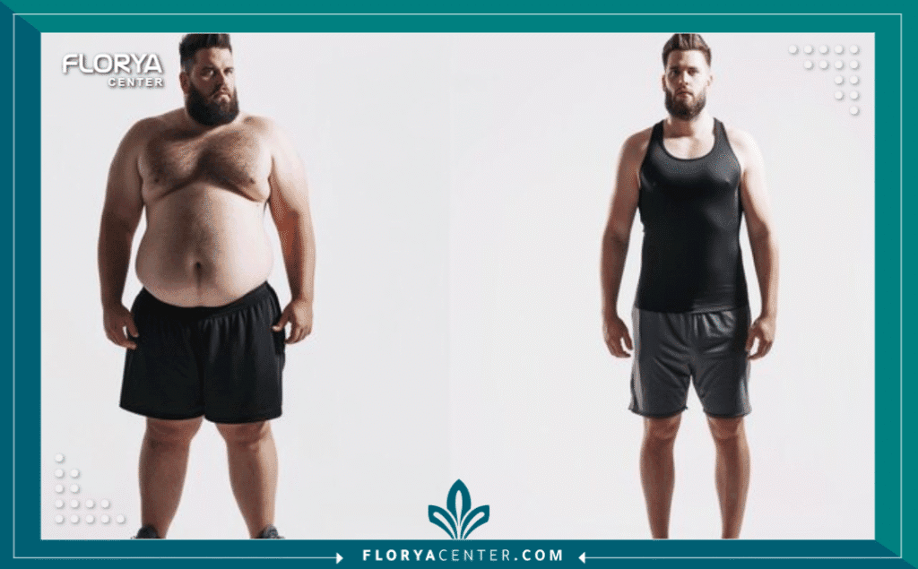 nouralagee93@gmail.com 20250827 110838 ٠٠٠٠ - تجارب جزائريين مع التكميم في تركيا تُعد تجارب جزائريين مع التكميم في تركيا من أكثر المواضيع بحثاً واهتماماً لمن يسعون لبداية جديدة في حياتهم الصحية. لم يعد قرار إجراء جراحة تكميم المعدة (Sleeve Gastrectomy) مجرد إجراء طبي، بل أصبح رحلة أمل تحظى فيها تركيا بثقة متزايدة. السمنة، التي تصنفها منظمة الصحة العالمية (WHO) كأحد تحديات الصحة العامة، تتطلب حلولاً جذرية عندما تفشل الطرق التقليدية.