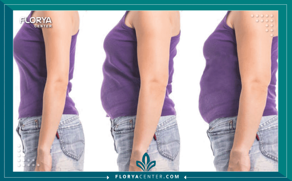 nouralagee93@gmail.com 20250827 110926 ٠٠٠٠ - نتائج عملية الساسي قبل وبعد تُظهر نتائج عملية الساسي قبل وبعد تحولاً جذرياً لا يقتصر فقط على الميزان، بل يمتد ليشمل استعادة الصحة والحيوية لمرضى السمنة المفرطة، خاصة أولئك الذين يعانون من أمراض استقلابية مصاحبة كالسكري من النوع الثاني. إن مشاهدة صور نتائج عملية الساسي قبل وبعد ليست مجرد مصدر إلهام، بل هي دليل قاطع على فعالية هذا الإجراء الطبي المتقدم.