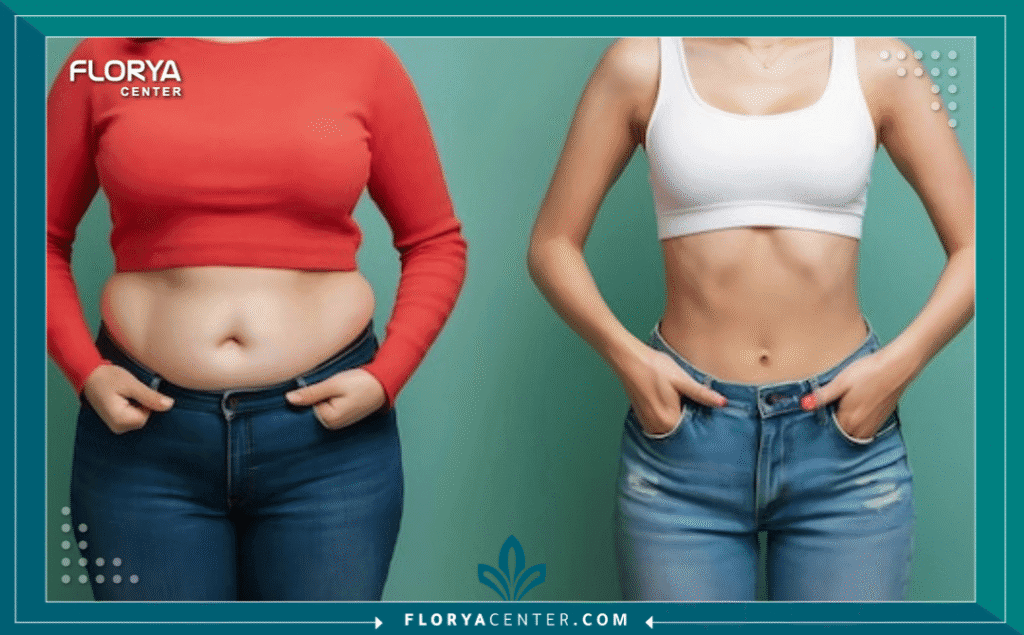 أفضل مستشفى عمليات السمنة للمقيمين بالسعودية 4 nouralagee93@gmail.com 20250828 123155 ٠٠٠٠ - أفضل مستشفى عمليات السمنة للمقيمين بالسعودية تعد السمنة من التحديات الصحية الكبرى في منطقة الخليج، ويبحث الكثيرون يومياً عن أفضل مستشفى عمليات السمنة للمقيمين بالسعودية لضمان الحصول على رعاية طبية فائقة وتكلفة معقولة. بالنسبة للمقيمين في المملكة، قد يكون العائق المادي أو عدم تغطية التأمين الطبي للعمليات الجراحية الاختيارية سبباً رئيسياً للبحث عن بدائل ذات جودة عالمية.