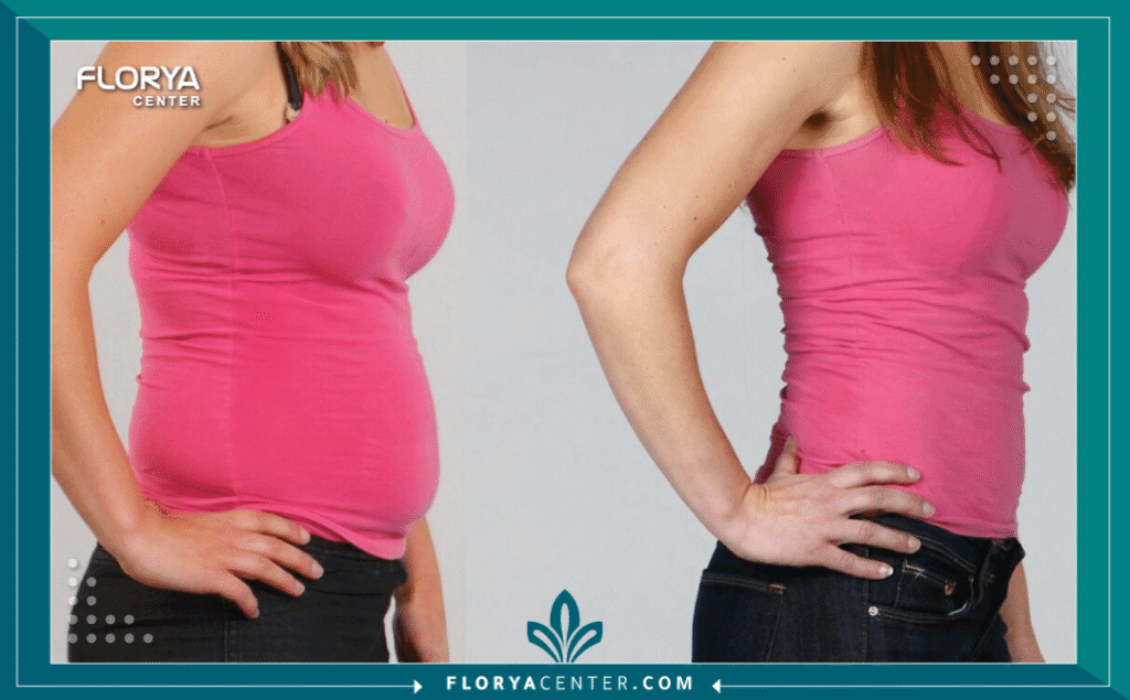 تكلفة عملية تحويل المسار في اسطنبول