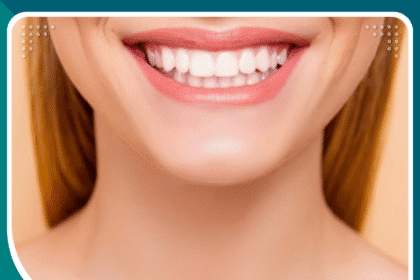 تكلفة ابتسامة هوليود