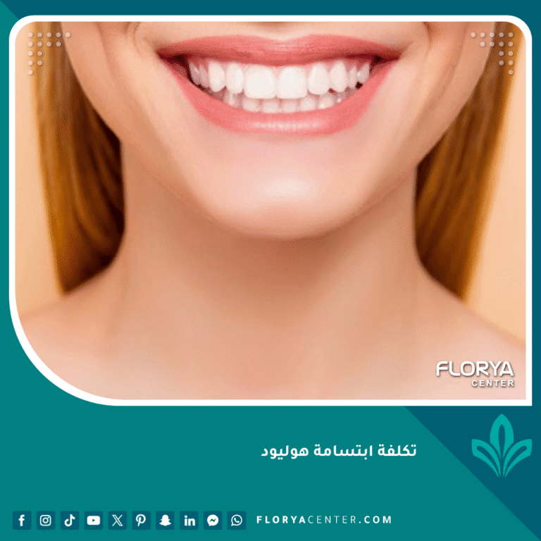 تكلفة ابتسامة هوليود