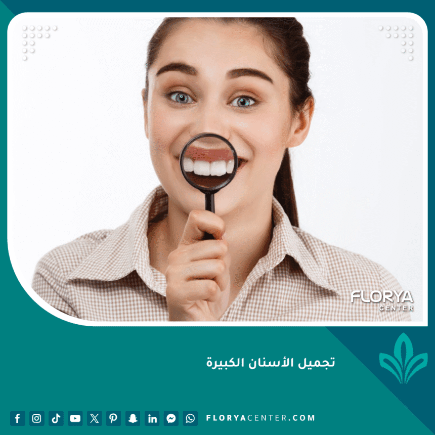 تجميل الأسنان الكبيرة