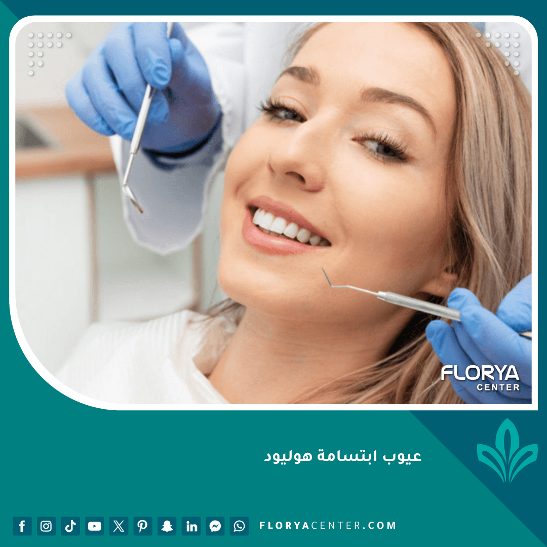 عيوب ابتسامة هوليود