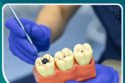 علاج تسوس الأسنان