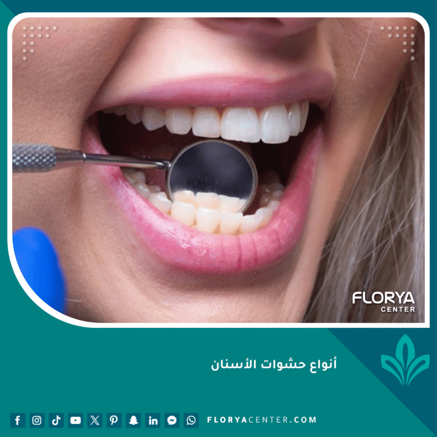 تكلفة حشو الأسنان