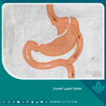 عملية تحويل المسار