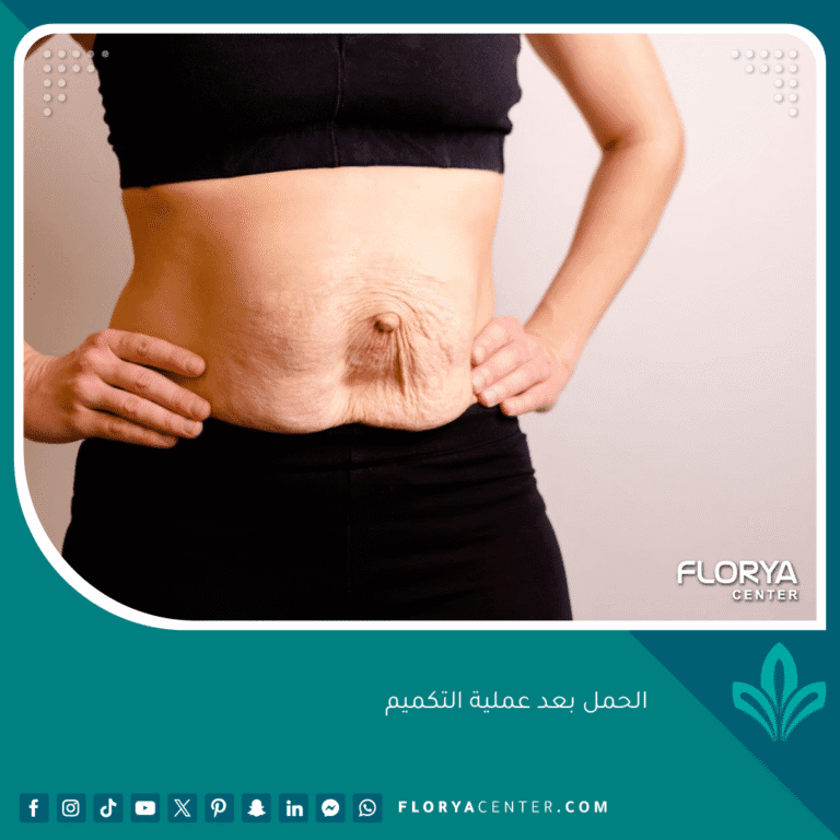 الحمل بعد عملية التكميم