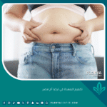 تكميم المعدة في تركيا أم مصر