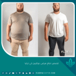 قصص نجاح مرضى عراقيين في تركيا