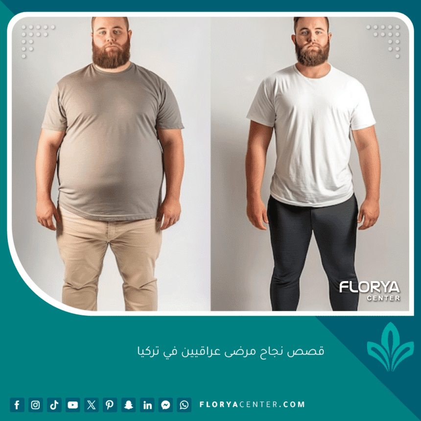 قصص نجاح مرضى عراقيين في تركيا