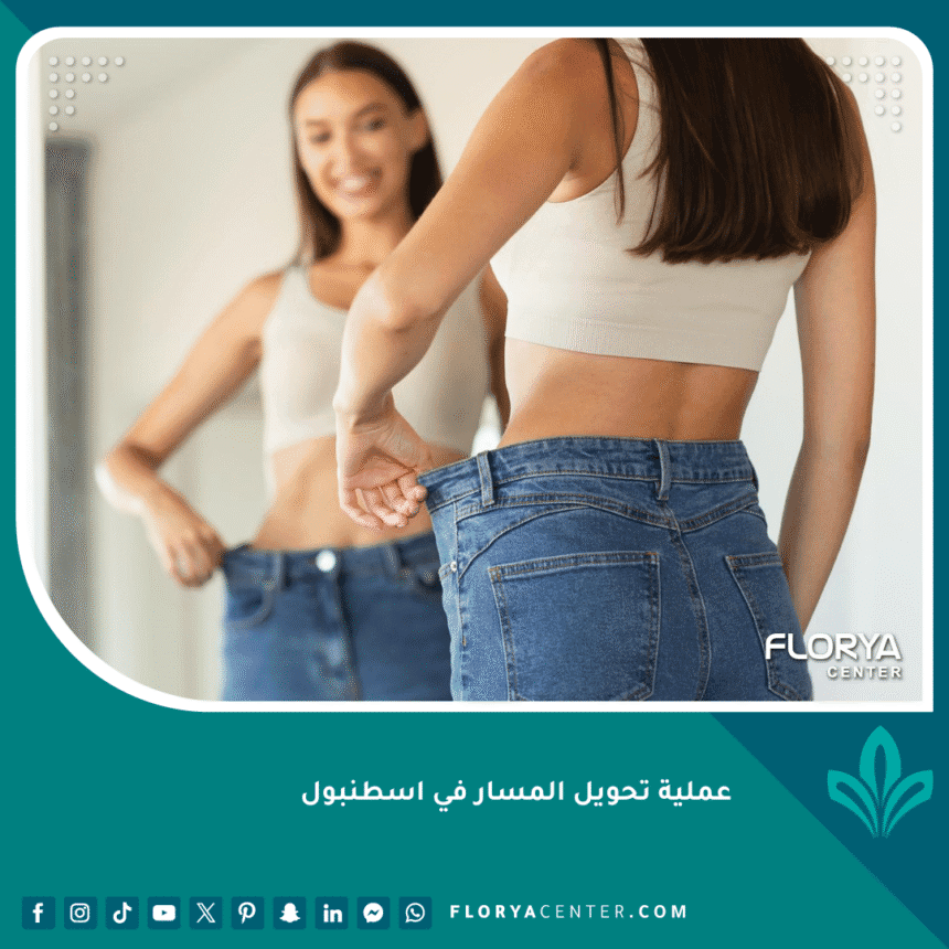 تكلفة عملية تحويل المسار في اسطنبول