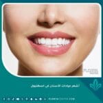 أشهر عيادات الأسنان في اسطنبول