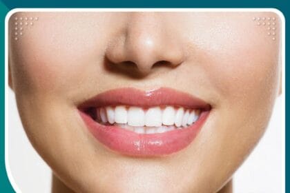 أشهر عيادات الأسنان في اسطنبول