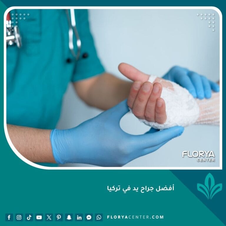 أفضل جراح يد في تركيا