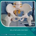عملية استبدال مفصل الورك في تركيا