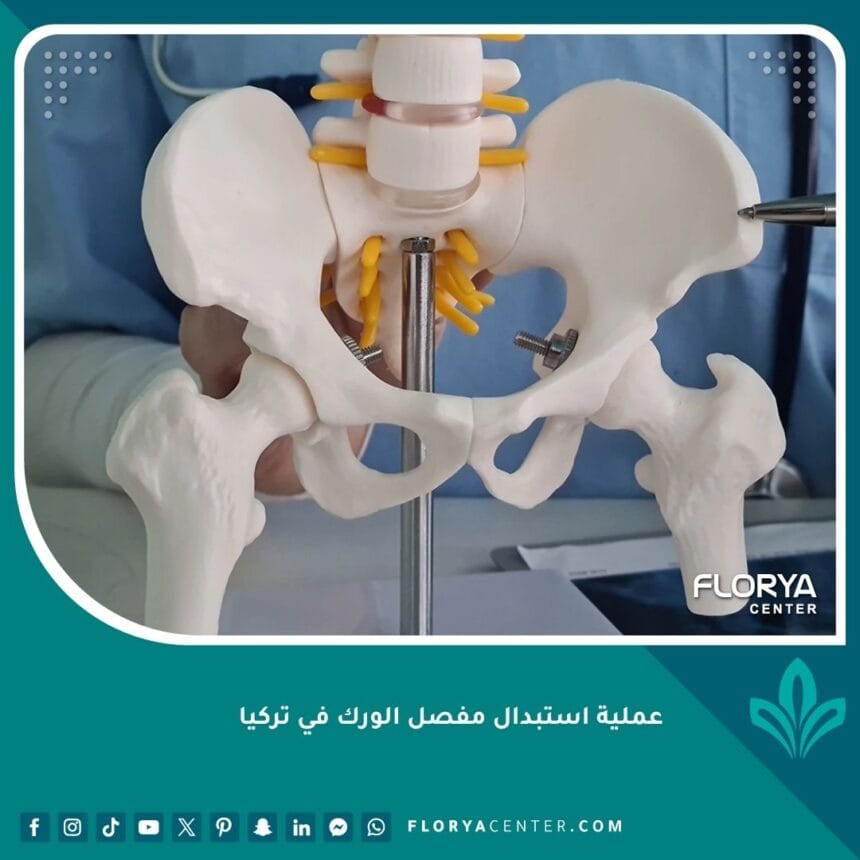 عملية استبدال مفصل الورك في تركيا