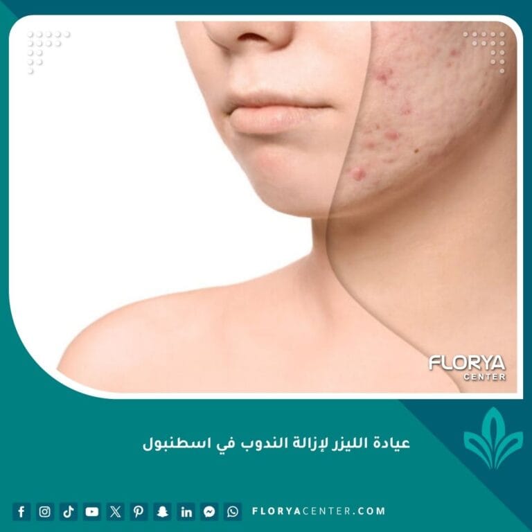 عيادة الليزر لإزالة الندوب في اسطنبول