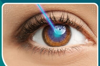 مراكز علاج العيون بالليزر في تركيا