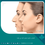أفضل دكتور تجميل أنف في تركيا