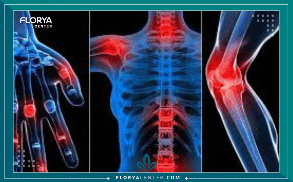 نسخة من Hayaalaje12 20250902 085807 ٠٠٠٠ - علاج العظام والمفاصل في تركيا يشهد قطاع السياحة العلاجية تطوراً متسارعاً، حيث برز علاج العظام والمفاصل في تركيا (Orthopedic and Joint Treatment in Turkey) كواحد من أهم الخيارات الطبية للمرضى القادمين من أوروبا والشرق الأوسط. لم يعد الأمر يقتصر على توفر المستشفيات فقط، بل تعدى ذلك إلى تقديم جودة طبية تضاهي المعايير العالمية بأسعار تنافسية. إن البحث عن علاج العظام والمفاصل في تركيا يعني الوصول إلى منظومة صحية متكاملة تعتمد على أحدث البروتوكولات العلاجية المعتمدة دولياً.