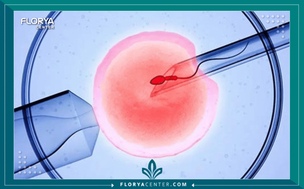 نسخة من Hayaalaje12 20250904 145941 ٠٠٠٠ - مستشفيات التلقيح الصناعي (IVF) في تركيا يُعد قرار البدء في رحلة التلقيح الصناعي (IVF) خطوة هائلة، وغالباً ما تكون تتويجاً لسنوات من التخطيط والأمل. إنها ليست مجرد إجراء طبي، بل هي استثمار عاطفي ومالي عميق نحو تحقيق حلم الأبوة والأمومة. في هذا السياق، أصبح اختيار الوجهة المناسبة للعلاج لا يقل أهمية عن العلاج نفسه. وهنا، تبرز تركيا كقوة عالمية رائدة. إن البحث عن أفضل مستشفيات التلقيح الصناعي (IVF) في تركيا لم يعد سراً، بل هو اتجاه متنامٍ يغذيه مزيج فريد من الخبرة الطبية الفائقة، والتكنولوجيا المتقدمة، والتكاليف المنطقية.