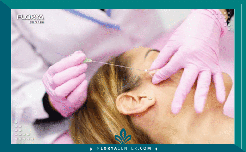 نسخة من Hayaalaje12 20250908 153553 ٠٠٠٠ - مركز شد الوجه بالخيوط في تركيا عند البحث عن أفضل مركز شد الوجه بالخيوط في تركيا، فإنك تبحث عن مزيج فريد من الخبرة الطبية المتقدمة والنتائج الطبيعية. لم يعد شد الوجه حكراً على العمليات الجراحية المعقدة؛ فمع تطور تقنيات الخيوط التجميلية، أصبح بالإمكان استعادة ملامح الشباب، وتحديد خط الفك، ورفع الخدود المترهلة خلال جلسة واحدة وبأقل فترة نقاهة ممكنة.