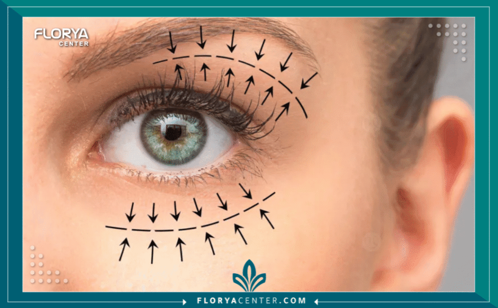 ٢٠٢٥٠٩١١ ٢٢١٧٥٤ - مركز شد الجفون بالخيوط في اسطنبول يُعد العثور على أفضل مركز شد الجفون بالخيوط في اسطنبول خطوة أساسية نحو استعادة نظرة شابة وحيوية للعينين دون الحاجة إلى مبضع الجراح. في السنوات الأخيرة، شهدت اسطنبول ثورة في عالم التجميل غير الجراحي، وأصبح شد الجفون بالخيوط (Non-surgical Thread Eyelid Lift) أحد أكثر الإجراءات طلباً، نظراً لفعاليته وقصر فترة التعافي.