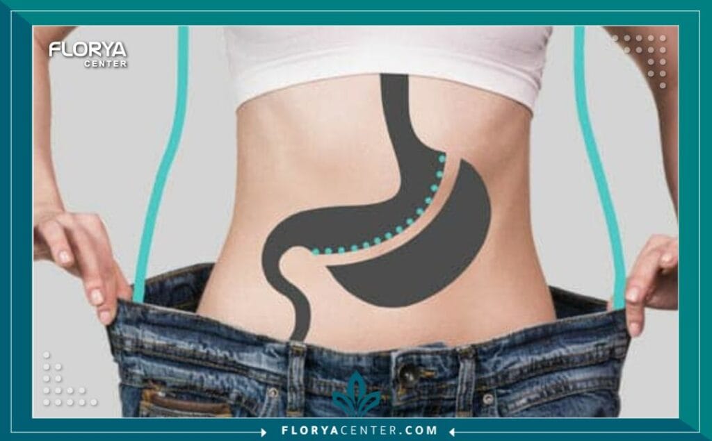 B2 1 - علاج السمنة في تركيا يُعتبر علاج السمنة في تركيا (Obesity Treatment / Bariatric Surgery) اليوم ثورة حقيقية في مجال الصحة العامة، مقدماً أملاً جديداً لملايين الباحثين عن حياة صحية. لم يعد هذا الإجراء محصوراً في إطار الرفاهية، بل أصبح مساراً علاجياً متكاملاً تقدمه مراكز متخصصة مثل "مركز فلوريا"، الذي يضمن رحلة علاجية مريحة تشمل خدمات لوجستية مجانية من إقامة ومواصلات وترجمة. إن السعي نحو علاج السمنة في تركيا هو استثمار مباشر في مستقبلك الصحي وجودة حياتك.