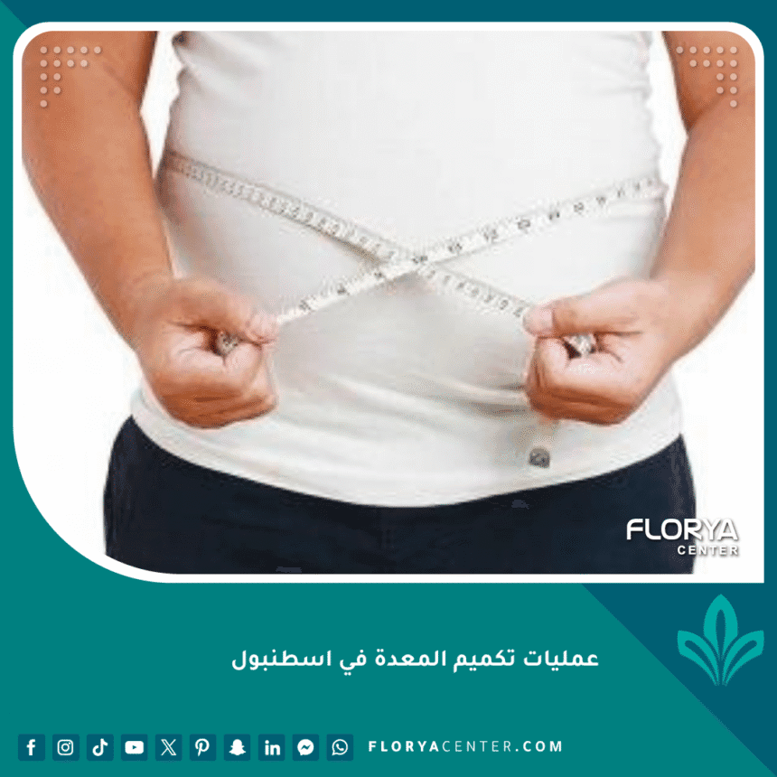 عمليات تكميم المعدة في اسطنبول