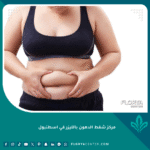 مركز شفط الدهون بالليزر في اسطنبول