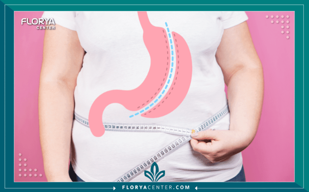 a1 2 - ميزات تكميم المعدة تُعد ميزات تكميم المعدة في تركيا (Gastric Sleeve) نقطة تحول جذرية في حياة الأفراد الباحثين عن حل دائم وفعال للسمنة المفرطة. ففي عالم تتسارع فيه وتيرة الحياة، أصبح البحث عن الصحة والرشاقة مطلباً أساسياً، وتقدم تركيا، وخصوصاً مراكز متقدمة مثل مركز فلوريا، هذه الفرصة الذهبية. إن فهم ميزات تكميم المعدة ليس مجرد رفاهية، بل هو ضرورة لفهم كيف يمكن لهذا الإجراء أن يغير مسار حياة المريض بالكامل، محققاً نتائج تفوق مجرد خسارة الوزن. تتعدد ميزات عملية تكميم المعدة لتشمل جوانب صحية ونفسية عميقة، وتبرز تركيا كوجهة أولى للاستفادة من ميزات التكميم بفضل خبراتها الطبية المتقدمة.