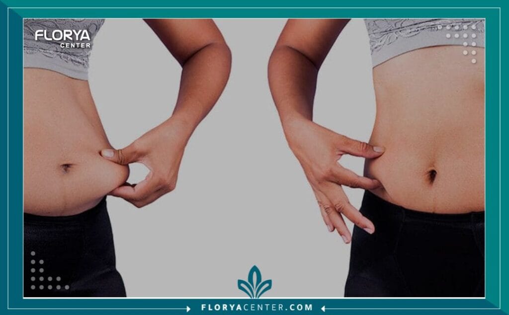 a3 5 - عمليات السمنة في تركيا تعد عمليات السمنة في تركيا نقطة تحول حاسمة في حياة الأفراد الذين يخوضون معركة طويلة الأمد مع الوزن الزائد. إنها ليست مجرد إجراء تجميلي، بل هي خطوة علاجية فعالة تُقدم حلاً مستداماً لمشكلة صحية عالمية معقدة. عندما تصبح الحمية الغذائية والتمارين الرياضية غير كافية لتحقيق نتائج صحية ملموسة، تبرز جراحة علاج البدانة (Bariatric Surgery) كأداة قوية لاستعادة السيطرة على الصحة وبدء فصل جديد من الحياة.