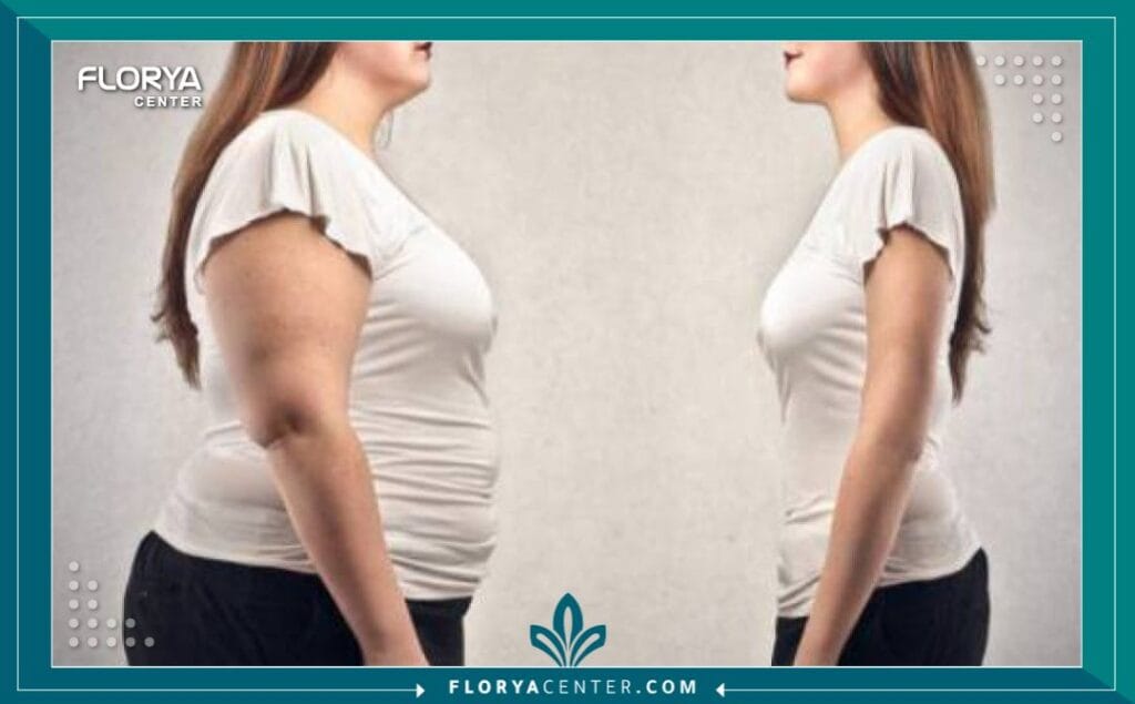 a4 8 - أفضل دكتور تكميم البحث عن دكتور تكميم موثوق ومتخصص يعد الخطوة الأهم والأكثر حسماً على طريق التخلص من السمنة وبدء حياة جديدة أكثر صحة ونشاطاً. عملية تكميم المعدة (Sleeve Gastrectomy) هي جراحة كبرى تتطلب جراحاً خبيراً يمتلك سجلاً حافلاً من النجاح والاحترافية. في هذا الدليل، لن نوفر عليك عناء البحث فحسب، بل سنقدم لك قائمة شاملة ومفصلة بأفضل 10 دكتور تكميم في تركيا، الوجهة العالمية لجراحة السمنة، مع التركيز على المعايير الصارمة التي يجب اعتمادها لضمان أفضل النتائج والمتابعة ما بعد العملية. لا ينبغي أن يكون اختيار دكتور تكميم مجرد بحث عن سعر، بل بحث عن الكفاءة والخبرة والدعم الشامل قبل وبعد الجراحة.