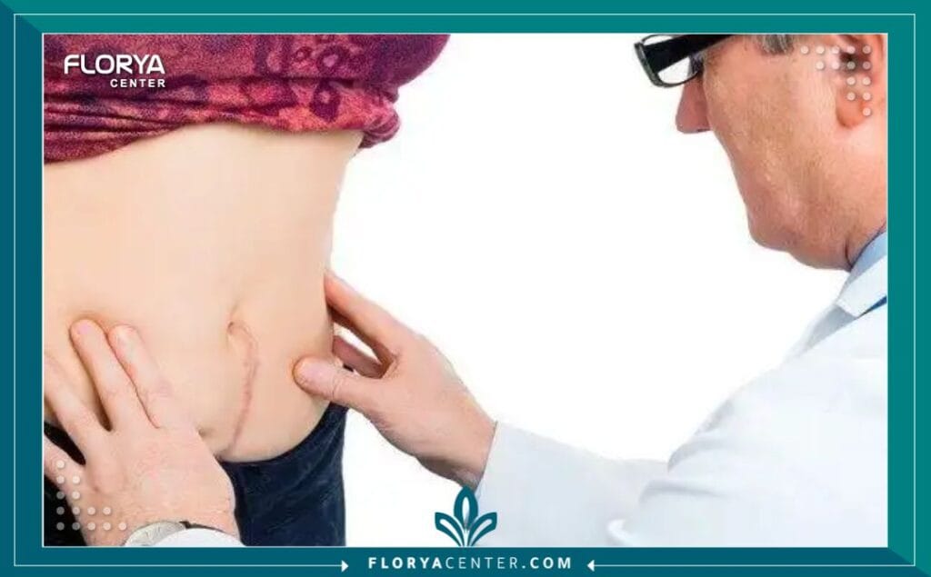 b1 8 - سعر عملية الساسي عندما يتعلق الأمر بتحقيق حلم الرشاقة والصحة، فإن السؤال عن سعر عملية الساسي في تركيا (Single Anastomosis Sleeve Ileal Bypass - SASI) يصبح هو البداية الحقيقية لرحلة التغيير. لقد أثبتت عملية الساسي في تركيا أنها إحدى أكثر الخيارات فعالية وأماناً وذكاءً للمرضى الذين يعانون من السمنة المفرطة، خاصة محبي السكريات. لكن، في بحر الخيارات الطبية، يظل البحث عن تكلفة عملية الساسي في تركيا الذي يوازن بين الجودة والتكلفة هو التحدي الأكبر. هذه المقالة هي دليلك المفصل الذي يزودك بكل معلومة تحتاجها لتحديد أسعار عملية الساسي في تركيا الحقيقي، ويضع بين يديك كل التفاصيل التي تجعل اختيارك لـ مركز فلوريا هو الخيار الأفضل بلا منازع للحصول على أفضل عروض عملية الساسي في تركيا.