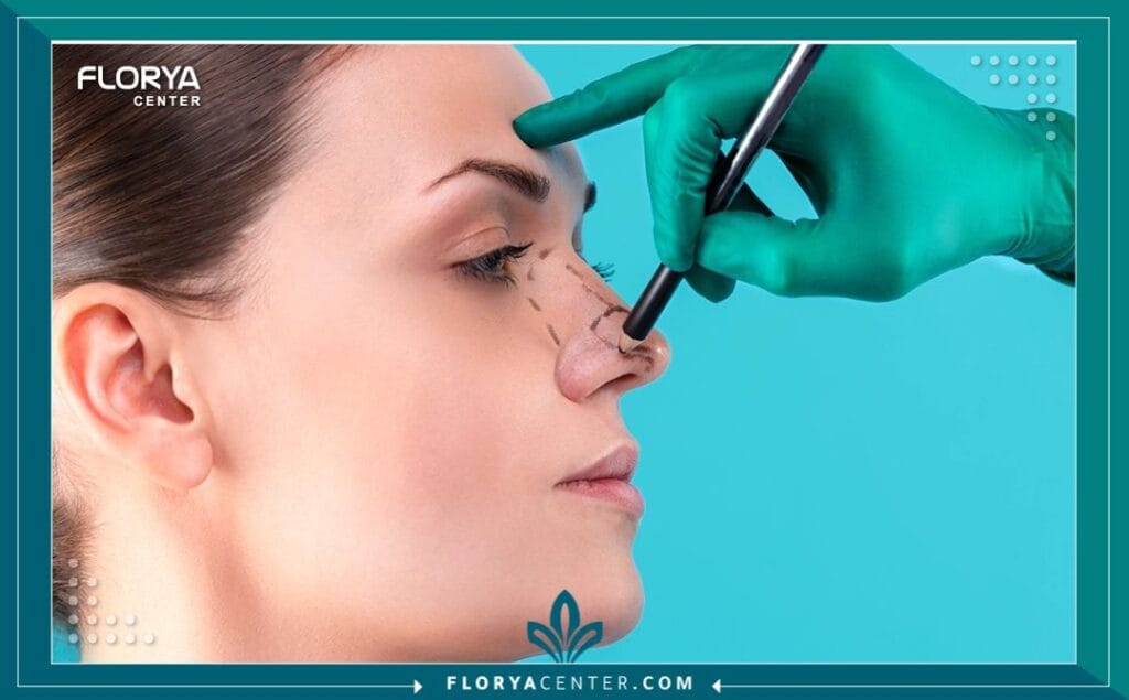 طبيب تصغير الأنف في تركيا 3 b2 17 - طبيب تصغير الأنف في تركيا يُعد قرار إجراء عملية تجميل الأنف (Rhinoplasty) أحد أهم القرارات الجمالية والوظيفية التي يمكن أن يتخذها الفرد. وعندما يبدأ هذا البحث، يبرز اسم تركيا كوجهة أولى عالمياً. إن البحث عن أفضل طبيب تصغير الأنف في تركيا ليس مجرد رفاهية، بل هو ضرورة لضمان الحصول على نتائج تتناغم مع ملامح الوجه وتحسن من جودة التنفس.
