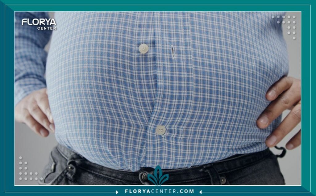 السمنة المفرطة 4 b3 4 - السمنة المفرطة تُعد السمنة المفرطة (Morbid Obesity) تحدياً صحياً عالمياً معقداً ومتزايداً، وهي ليست مجرد زيادة في الوزن، بل هي مرض مزمن وخيم يؤثر بشكل كبير على جودة الحياة. يتم تشخيص السمنة المفرطة طبياً عندما يصل مؤشر كتلة الجسم (BMI) إلى 40 أو أعلى، أو 35 مصحوباً بحالات مرضية خطيرة مرتبطة بالوزن. في ظل هذا الواقع، يبحث الملايين عن حلول فعالة ومستدامة، وتبرز تركيا، وتحديداً مراكز مثل "مركز فلوريا"، كوجهة رائدة تقدم أحدث ما توصل إليه الطب في هذا المجال، مانحةً أملاً حقيقياً بحياة جديدة وصحية. إن فهم أبعاد السمنة المفرطة هو الخطوة الأولى نحو التغلب عليها.