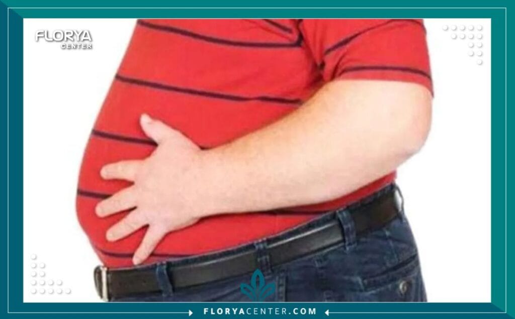 السمنة المفرطة 5 b4 3 - السمنة المفرطة تُعد السمنة المفرطة (Morbid Obesity) تحدياً صحياً عالمياً معقداً ومتزايداً، وهي ليست مجرد زيادة في الوزن، بل هي مرض مزمن وخيم يؤثر بشكل كبير على جودة الحياة. يتم تشخيص السمنة المفرطة طبياً عندما يصل مؤشر كتلة الجسم (BMI) إلى 40 أو أعلى، أو 35 مصحوباً بحالات مرضية خطيرة مرتبطة بالوزن. في ظل هذا الواقع، يبحث الملايين عن حلول فعالة ومستدامة، وتبرز تركيا، وتحديداً مراكز مثل "مركز فلوريا"، كوجهة رائدة تقدم أحدث ما توصل إليه الطب في هذا المجال، مانحةً أملاً حقيقياً بحياة جديدة وصحية. إن فهم أبعاد السمنة المفرطة هو الخطوة الأولى نحو التغلب عليها.