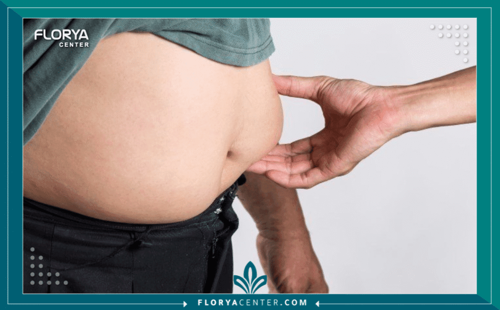 تكميم المعدة قبل وبعد 5 c4 - تكميم المعدة قبل وبعد تبدأ رحلة البحث عن تحول جذري للوزن والصحة بالكلمة المفتاحية: تكميم المعدة قبل وبعد. إنها رحلة تتجاوز المظهر الخارجي لتلامس صميم الصحة وجودة الحياة. تُعرف عملية تكميم المعدة (Vertical Sleeve Gastrectomy - VSG) بأنها إجراء جراحي رائد في مجال جراحة السمنة، يهدف إلى تقليص حجم المعدة بشكل دائم، مما يحد من كمية الطعام المتناولة ويقلل من إفراز هرمون الجوع (الجريلين).