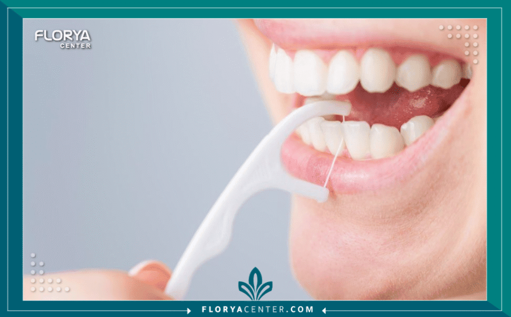 nouralagee93@gmail.com 20250906 131953 ٠٠٠٠ - أهمية استخدام خيط الأسنان تكمن أهمية استخدام خيط الأسنان في كونه خط الدفاع الأول ضد مشاكل الفم الأكثر تعقيداً، والتي تبدأ غالباً من المناطق التي تعجز فرشاة الأسنان عن الوصول إليها. يعتقد الكثيرون أن تنظيف الأسنان بالفرشاة مرتين يومياً كافٍ، لكن الحقيقة الطبية، كما تؤكدها الجمعية الأمريكية لطب الأسنان (ADA)، هي أن الفرشاة تنظف حوالي 60% فقط من أسطح الأسنان. الـ 40% المتبقية، وهي المناطق البينية (بين الأسنان) وتحت خط اللثة، تصبح مرتعاً للبكتيريا. إن إدراك أهمية استخدام خيط الأسنان ليس رفاهية، بل هو ضرورة أساسية لإكمال عملية التنظيف ومنع أمراض اللثة والتسوس البيني، وهو ما نعتبره في "مركز فلوريا" الركيزة الأساسية لصحة الفم المستدامة. إن عملية تنظيف الأسنان بالخيط (Dental Flossing) هي الإجراء الوقائي الأدق والأكثر فعالية.